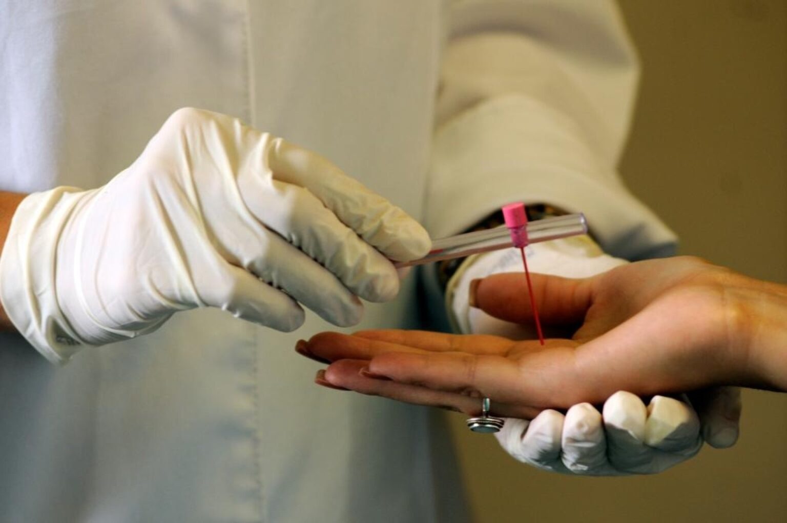 Mato Grosso Intensifica Ações Contra a Hanseníase em 2024 | Saúde em Foco