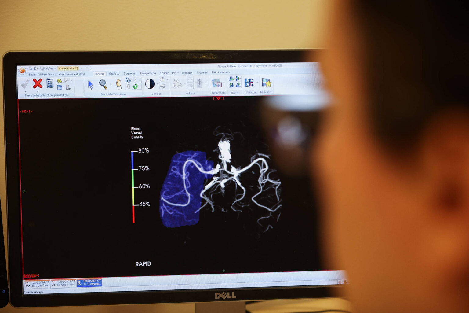 Desempenho da IA na Saúde: Teoria vs. Prática com Pacientes Reais Desempenho da IA na Saúde: Teoria vs. Prática com Pacientes Reais